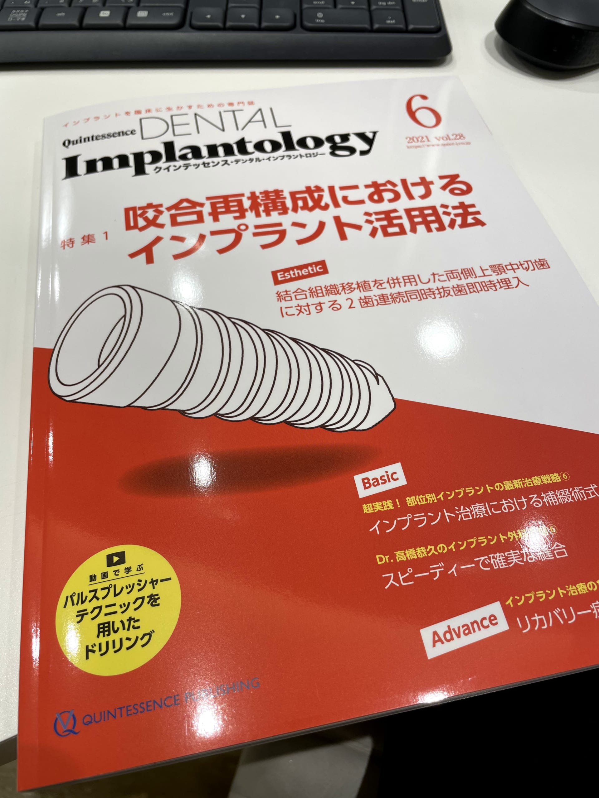歯科雑誌「Quintessence DENTAL Implantlogy」での連載が終了！ - 丸尾 